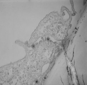 TEM image of a cell infected with HSV-1 on a co-culture carrier.